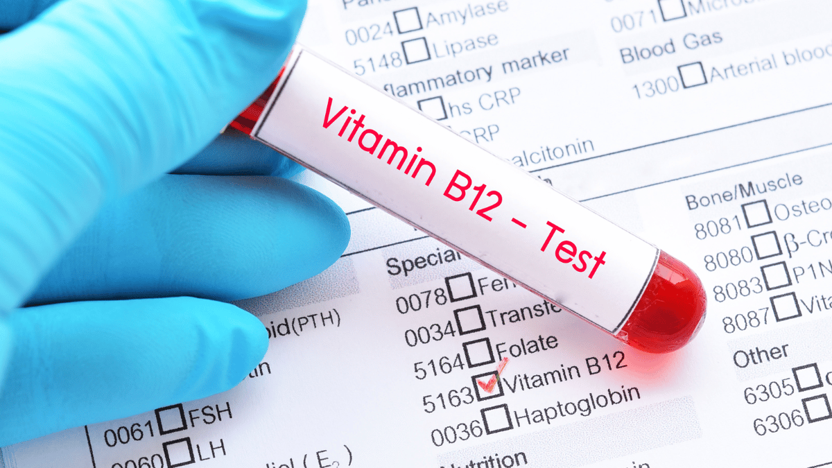 medical gloved hand holding a vitamin b12 test sample above a test result sheet